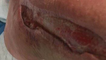 Los médicos del hospital Kaiser