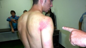 Las marcas sobre el cuerpo