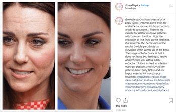 La imagen que se publicó en Instagram y que ya fue borrada de la cuenta de la clínica