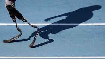 Así son las extremidades artificiales