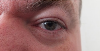 En las mayoría de casos