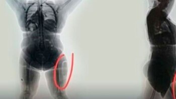 Las autoridades le realizaron un