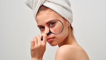 El acné es la afección