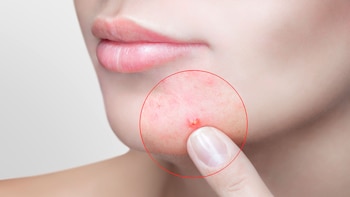 Es muy importante la visita