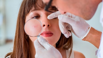 El dermatólogo determinará el tipo