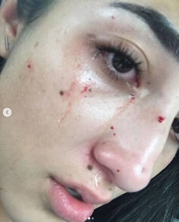 Después del hecho su mamá