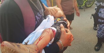 Un bebé, de 11 meses,