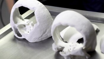 El paciente fue atropellado por