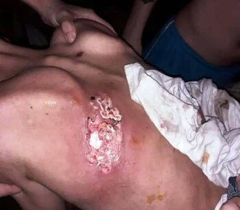 Los presos están expuestos a