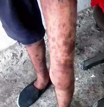 Las piernas de uno de