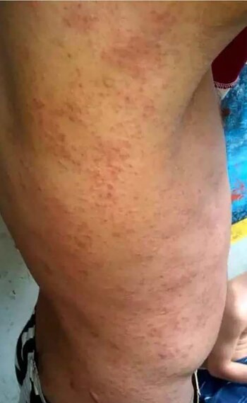 Las condiciones de reclusión son