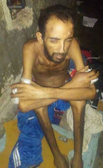 Un preso con varios golpes