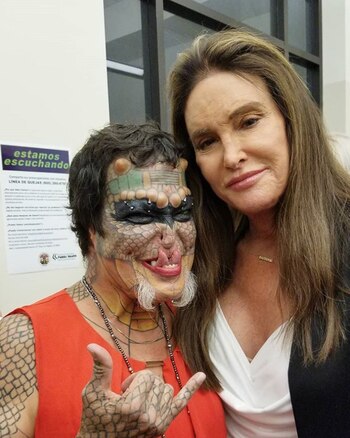 Tomó hormonas para que le