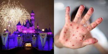 La vacuna contra el sarampión se aplica al año de vida y se repite al ingreso escolar (Foto: Archivo)