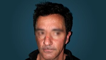 Walter “Cotorra Loca” Guillén Bustamante