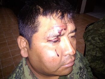 Uno de los elementos castrenses que resultó herido (Foto: @AnyerNavi)