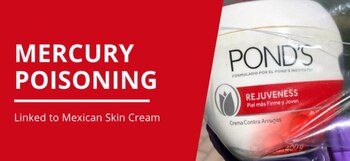 La crema que la víctima utilizó es la conocida como Pond’s Rejuvenecess, la cual sirve para “aclarar la piel, así como eliminar manchas y arrugas”. (Foto: Departamento de Salud de Sacramento)