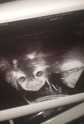 La joven de 17 años