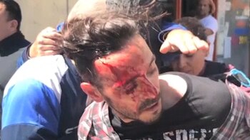 El delicnuente fue linchado por