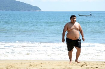 La obesidad, hipertensión y diabetes